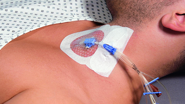 Curafix i.v. Control, Lohmann & Rauscher - Fixierpflaster mit transparentem Sichtfenster