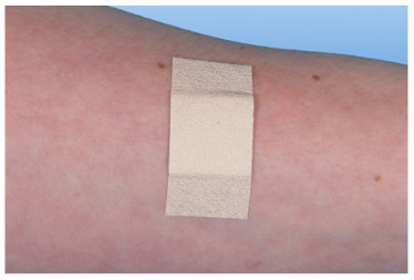 RUDAMED soft - Wundschnellverband für empfindliche Haut