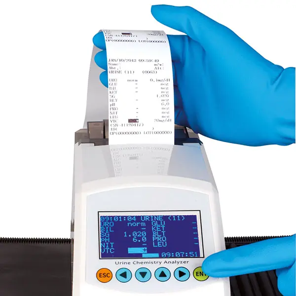 Analysegerät Servotest Reader für Urinteststreifen - Mit eingebautem Thermodrucker