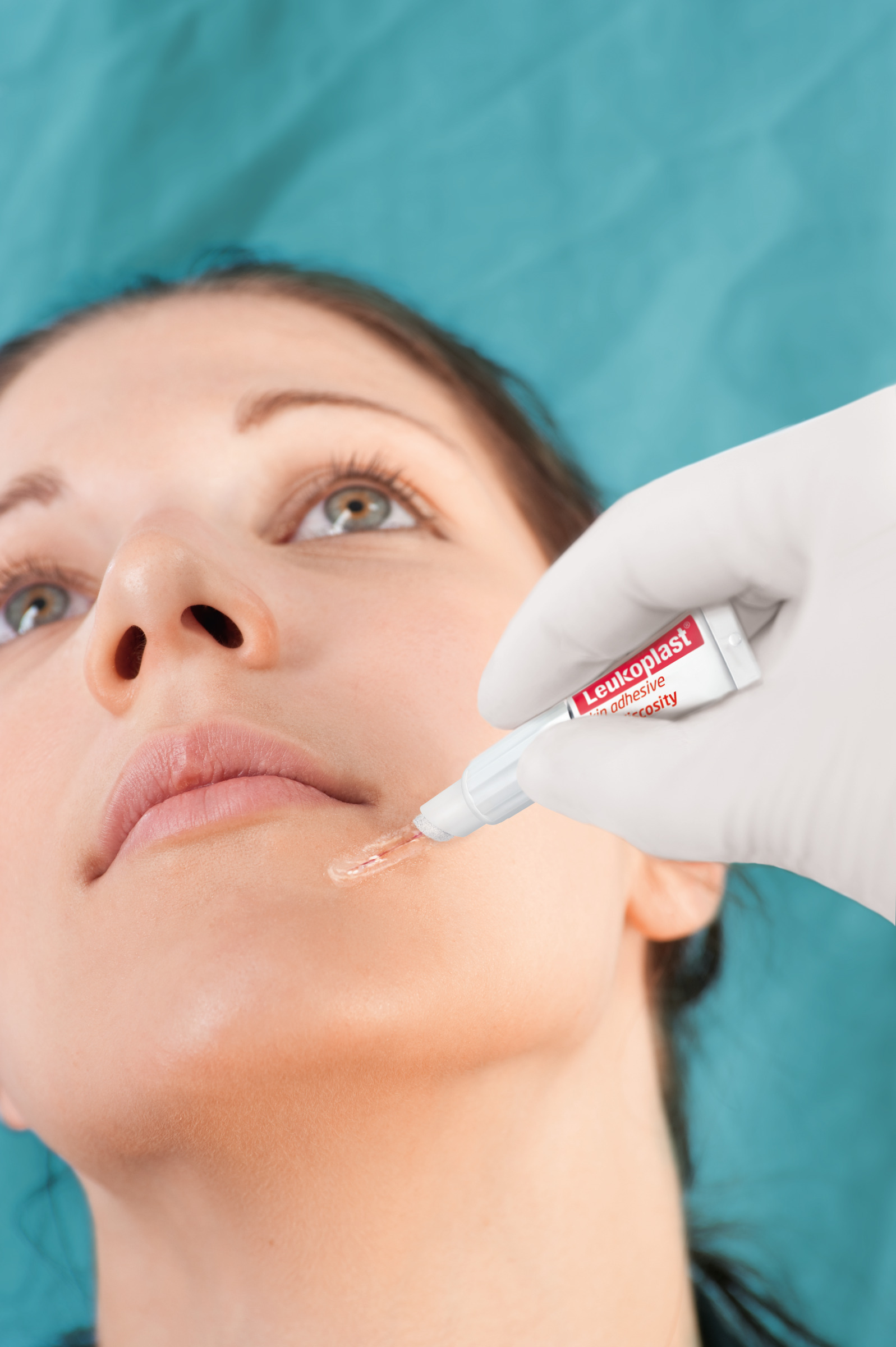 Leukoplast Skin Adhesive Hautkleber - 10 Dosiertuben mit 2-in-1 Applikator