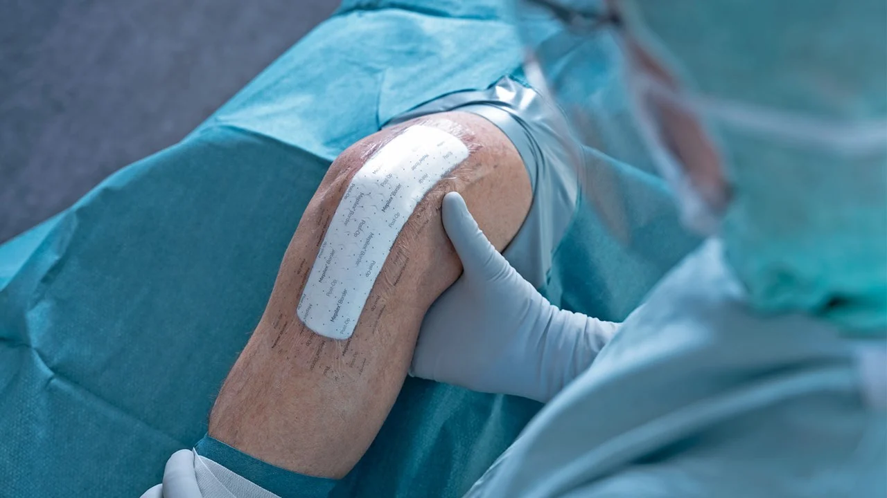 Mepilex Border Post-OP - Flexibler Komplettverband für chirurgische Wunden, steril