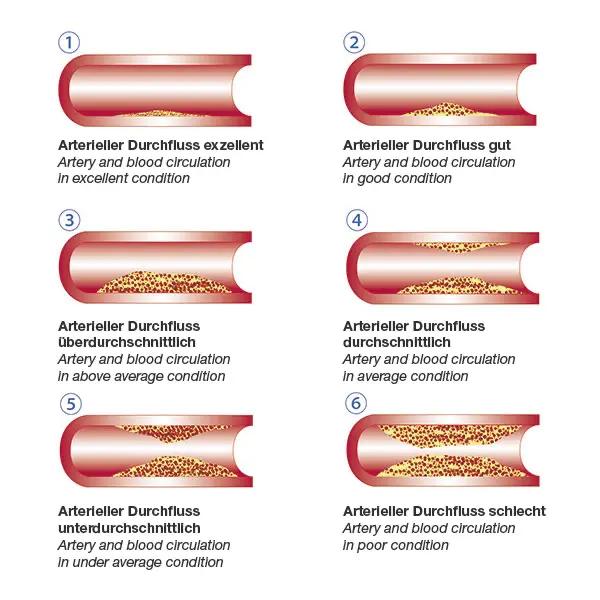 Vascular-Check Pulsoximeter - Anzeige von Sauerstoffsättigung, Puls und Phlethysmogramm